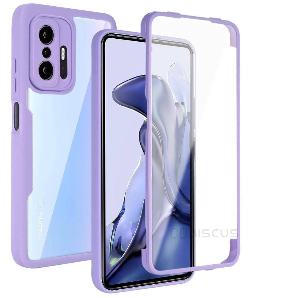 Case For Xiaomi Mi 11T Pro Funda Coque Carcasa Luxury 360 Full Protective Phone Case For Xiaomi 11i 11X Cover Shockproof