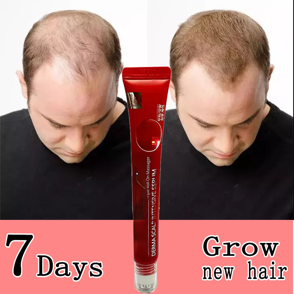 Biotin Fast 2023 Hair Growth Oil Hair Regrowth Serum Hair Thinning Treatment Hair Growth Liquid Anti-Hair Loss