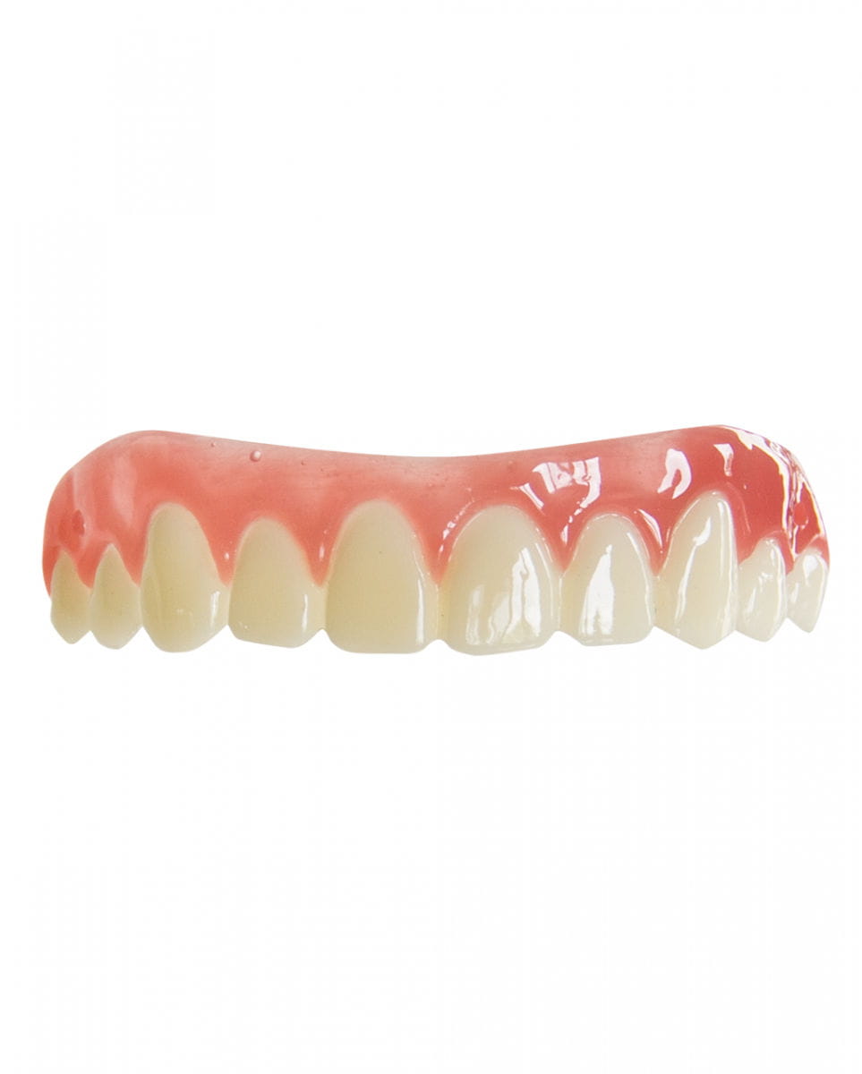 Mens Smile Dental FX Veneers